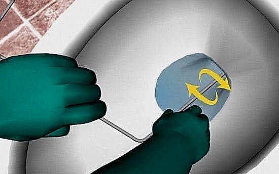 klozet açma yöntemleri